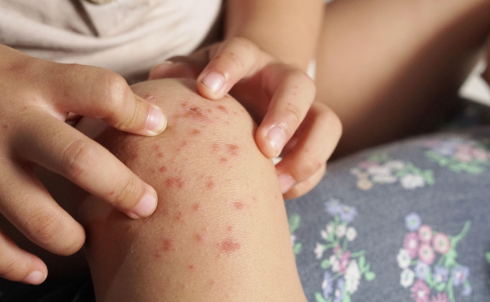 惡劣醫護夫妻！隱匿女兒腸病毒 「跑班」害14童染疫… 校方啟動停課