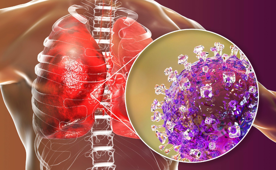 【一文看懂】致死率4成起跳！印度爆立百病毒疫情　這是什麼疾病？