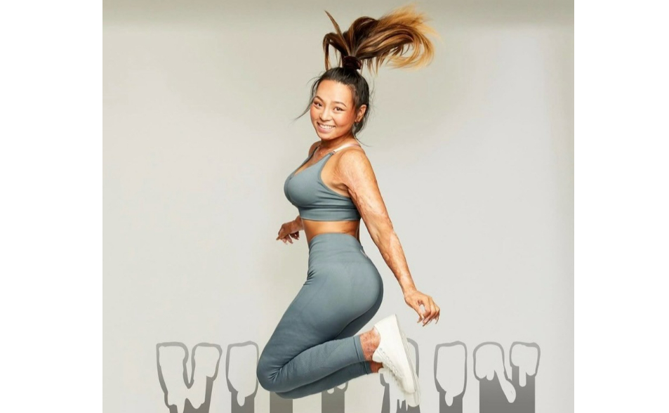 【重啟新頁-2】八仙塵爆78%燒燙傷！她的和解重生之路   朱俐：心裡面的石頭放下了