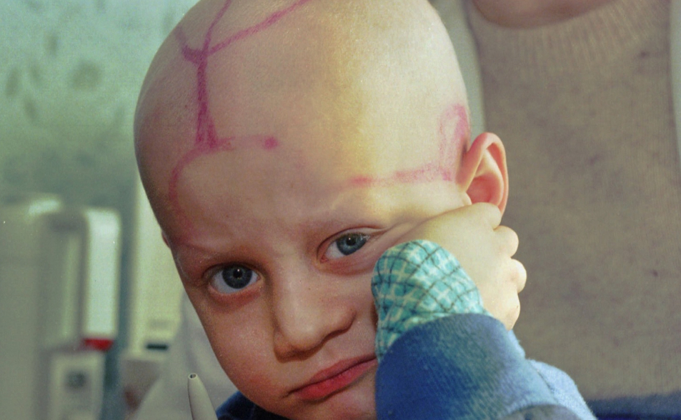 他「變成一頭怪物」死去　車諾比核災40年《悲鳴》揭人間煉獄